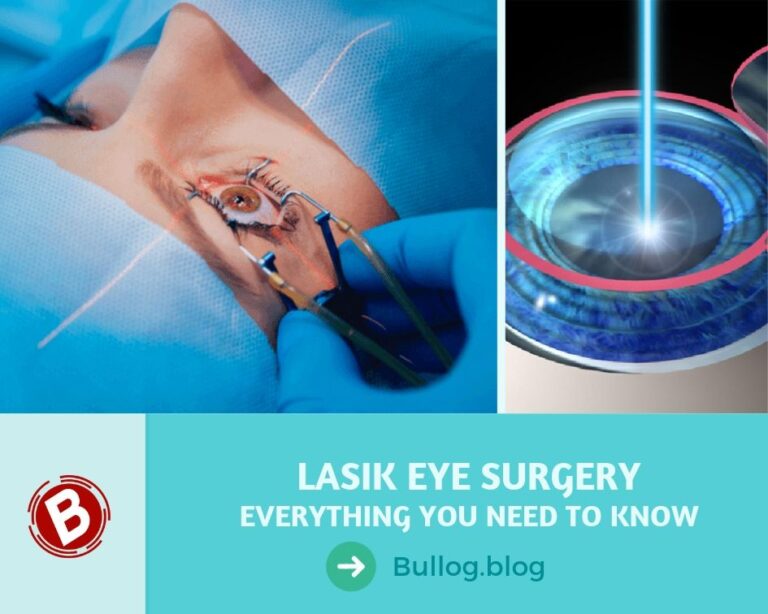 How LASIK Eye Surgery Works Procedure, Risks, Cost and Recovery
